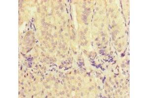 Immunohistochemistry of paraffin-embedded human adrenal gland tissue using ABIN7175563 at dilution of 1:100 (VDAC2 anticorps  (AA 2-36))