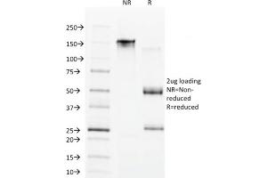 SDS-PAGE Analysis Purified CDX1 Mouse Monoclonal Antibody (CDX1/1650). (CDX1 anticorps)