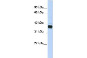 WB Suggested Anti-NUDT18 Antibody Titration:  0. (NUDT18 anticorps  (C-Term))