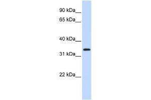 WB Suggested Anti-FLJ23356 Antibody Titration:  0. (SGK196 anticorps  (N-Term))