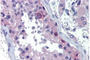 anti-Rhox Homeobox Family, Member 2 (RHOXF2) (AA 108-157) antibody