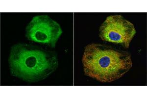 ICC/IF Image Stathmin 1 antibody detects Stathmin 1 protein at cytoplasm by immunofluorescent analysis.