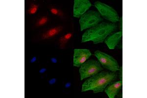 ABIN6257871 and ABIN6273773 staining  cells by IF/ICC.