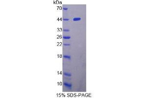 SDS-PAGE analysis of Human WARS2 Protein. (WARS2 Protéine)