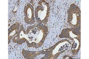 IHC analysis of RPL32 using anti-RPL32 antibody (ABIN7602916). (RPL32 anticorps  (C-Term))