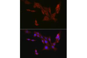 Immunofluorescence analysis of PC-12 cells using EIF4ENIF1 Rabbit pAb (ABIN7267051) at dilution of 1:100 (40x lens). (EIF4ENIF1 anticorps  (AA 150-250))