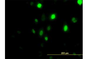 Immunofluorescence of monoclonal antibody to PLK1 on HeLa cell.
