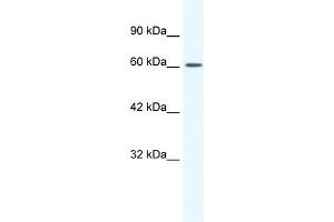 WB Suggested Anti-CACNB2 Antibody Titration:  1. (CACNB2 anticorps  (Middle Region))