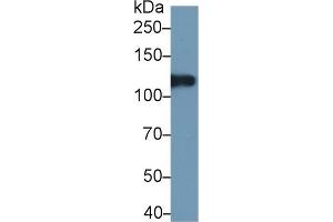 Detection antibody from the kit in WB with Positive Control:  Sample Human lung lysate.