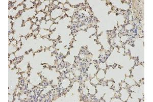 Immunohistochemistry (IHC) image for anti-4-Aminobutyrate Aminotransferase (ABAT) antibody (ABIN1876487) (ABAT anticorps)
