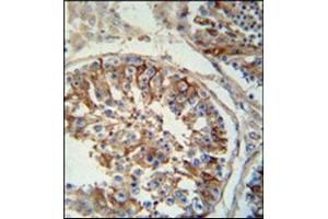 Immunohistochemistry analysis in Formalin Fixed, Paraffin Embedded Human testis tissue stained with SACA1 antibody (N-term) Cat.