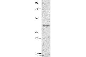 Western blot analysis of 231 cell  , using NTSR1 Polyclonal Antibody at dilution of 1:800 (NTSR1 anticorps)