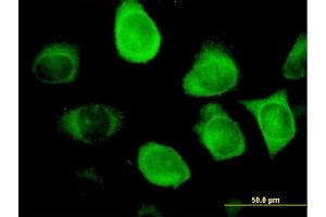 Immunofluorescence of monoclonal antibody to KRT18 on HeLa cell.