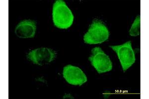 Immunofluorescence of monoclonal antibody to KRT18 on HeLa cell. (Cytokeratin 18 anticorps  (AA 1-430))