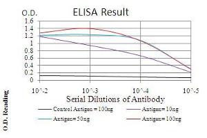 Black line: Control Antigen (100 ng), Purple line: Antigen(10 ng), Blue line: Antigen (50 ng), Red line: Antigen (100 ng), (Ezrin anticorps  (AA 292-464))