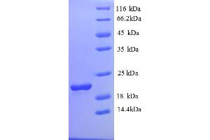 SDS-PAGE (SDS) image for Solute Carrier Family 41, Member 2 (SLC41A2) (AA 1-162), (Extracellular) protein (His tag) (ABIN5710374)