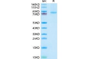 Human 4-1BB Ligand (Trimer) on Tris-Bis PAGE under reduced condition.