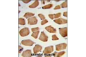 Formalin-fixed and paraffin-embedded human skeletal muscle reacted with PHYH Antibody (N-term), which was peroxidase-conjugated to the secondary antibody, followed by DAB staining.
