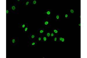 Immunofluorescence staining of Hela cells (treated with 30mM sodium butyrate for 4h) with ABIN7139160 at 1:1.