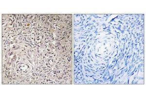 Immunohistochemistry (IHC) image for anti-Glucosaminyl (N-Acetyl) Transferase Family Member 7 (GCNT7) (C-Term) antibody (ABIN1850894) (GCNT7 anticorps  (C-Term))