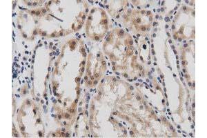Image no. 2 for anti-DnaJ (Hsp40) Homolog, Subfamily A, Member 2 (DNAJA2) antibody (ABIN1497862)