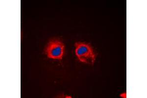 Immunofluorescent analysis of Cortactin (pY466) staining in HeLa cells. (Cortactin anticorps  (C-Term, pTyr466))