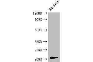 Western Blot Positive WB detected in: SH-SY5Y whole cell lysate All lanes: GNPNAT1 antibody at 1:2000 Secondary Goat polyclonal to rabbit IgG at 1/50000 dilution Predicted band size: 21 kDa Observed band size: 21 kDa (GNPNAT1 anticorps  (AA 1-184))