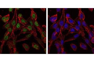 Immunofluorescence analysis of 3T3-L1 cells using CCT2 mouse mAb (green). (CCT2 anticorps)