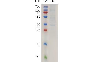Human C Protein, hFc Tag on SDS-PAGE under reducing condition.