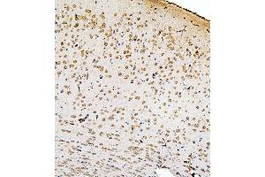 IHC analysis of SMAD2 using anti-SMAD2 antibody (ABIN6719361). (SMAD2 anticorps  (AA 83-264))