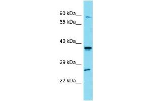 Western Blotting (WB) image for anti-Solute Carrier Family 35, Member G4 (SLC35G4) (N-Term) antibody (ABIN2791457) (SLC35G4 anticorps  (N-Term))