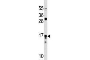 IL17RC antibody western blot analysis in Jurkat lysate.