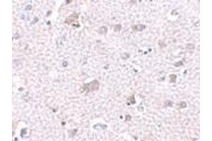 Immunohistochemistry of CDNF in human brain tissue with CDNF antibody at 2.