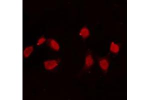 ABIN6274165 staining Hela cells by IF/ICC. (Topoisomerase II alpha anticorps  (Internal Region))