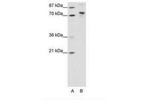 Image no. 1 for anti-TOX High Mobility Group Box Family Member 4 (TOX4) (N-Term) antibody (ABIN307424) (TOX4 anticorps  (N-Term))