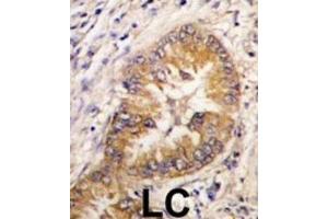Immunohistochemistry (IHC) image for anti-Cell Division Cycle Associated 8 (CDCA8) antibody (ABIN2998016) (CDCA8 anticorps)