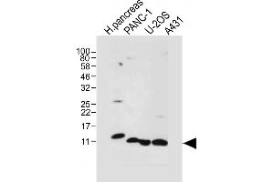 All lanes : Anti-REG3A Antibody (N-term) at 1:1000 dilution Lane 1: Human ncreas tissue lysate Lane 2: NC-1 whole cell lysate Lane 3: U-2OS whole cell lysate Lane 4: A431 whole cell lysate Lysates/proteins at 20 μg per lane. (REG3A anticorps  (N-Term))