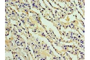 Immunohistochemistry of paraffin-embedded human lung tissue using ABIN7142914 at dilution of 1:100 (AKAP8L anticorps  (AA 1-240))
