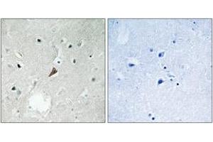 Immunohistochemistry analysis of paraffin-embedded human brain, using PYK2 (Phospho-Tyr579) Antibody. (PTK2B anticorps  (pTyr579))