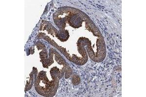 Immunohistochemical staining of human prostate with KBTBD8 polyclonal antibody  shows strong cytoplasmic positivity in glandular cells.