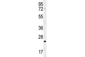 H-RAS antibody western blot analysis in mouse cerebellum tissue lysate.