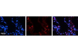 STAT6 antibody - C-terminal region          Formalin Fixed Paraffin Embedded Tissue:  Human Lung Tissue    Observed Staining:  Cytoplasm of pneumocytes   Primary Antibody Concentration:  1:600    Secondary Antibody:  Donkey anti-Rabbit-Cy3    Secondary Antibody Concentration:  1:200    Magnification:  20X    Exposure Time:  0.