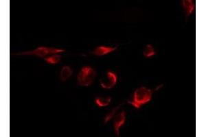 ABIN6275412 staining HuvEc by IF/ICC. (PPP1R7 anticorps  (C-Term))