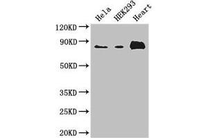 Western Blot Positive WB detected in: Hela whole cell lysate, HEK293 whole cell lysate, Mouse heart tissue All lanes: ABLIM1 antibody at 3. (ABLIM1 anticorps  (AA 174-319))