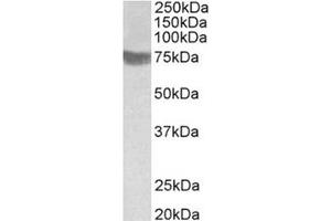 Image no. 1 for anti-Ring Finger Protein 139 (RNF139) (C-Term) antibody (ABIN375132) (RNF139 anticorps  (C-Term))
