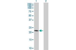 Western Blot analysis of AK1 expression in transfected 293T cell line by AK1 MaxPab polyclonal antibody. (Adenylate Kinase 1 anticorps  (AA 1-194))