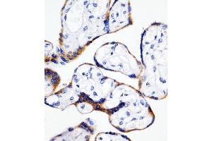 (ABIN6243144 and ABIN6578669) staining Cyclophilin B in human placenta tissue sections by Immunohistochemistry (IHC-P - paraformaldehyde-fixed, paraffin-embedded sections).