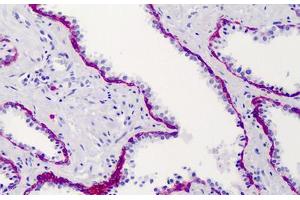 Human Prostate: Formalin-Fixed, Paraffin-Embedded (FFPE) (Syndecan 1 anticorps)