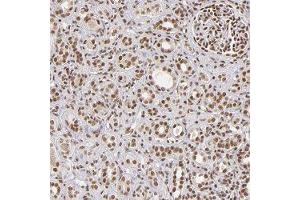 Immunohistochemical staining of human kidney with ZNF148 polyclonal antibody  shows distinct nuclear positivity in cells in tubules and glomeruli. (ZNF148 anticorps)