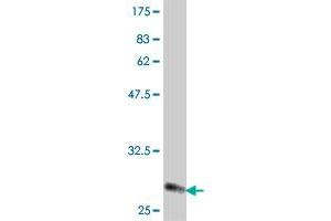 Western Blot detection against Immunogen (31.